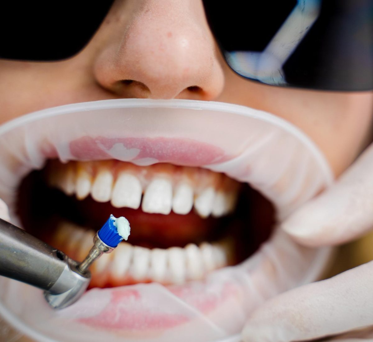 IvmLW_7jhfFfWeEftWUgQ0cupV9IurxtUSILACNoGK8wzZpdFd-u6ZCjbuef0qLtaTXjSPB4hQbwWCSdlsSwG4EiS_jlJHwTXM4nss9LNdI