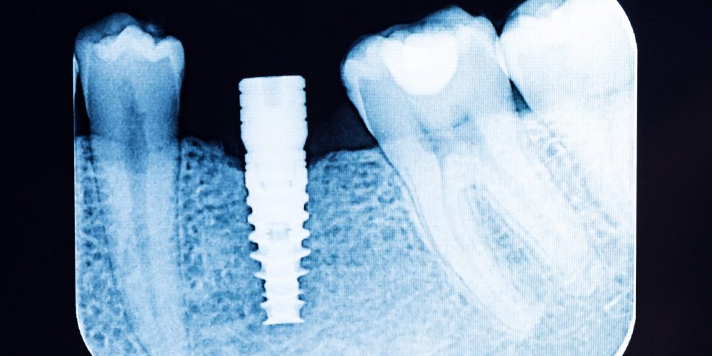 shutterstock_597942311-min-scaled.jpg.optimal